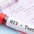 HIV Beratung HIV Beratung